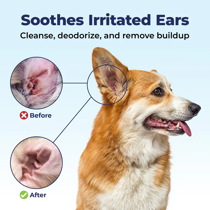 Oticbliss™ Advanced Cleaning Ear Wipes - 100 ct